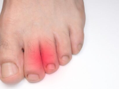 Finger- und Knöchelschutz: Weicher Schutz für die Finger vor Druck, Reibung und Prellungen