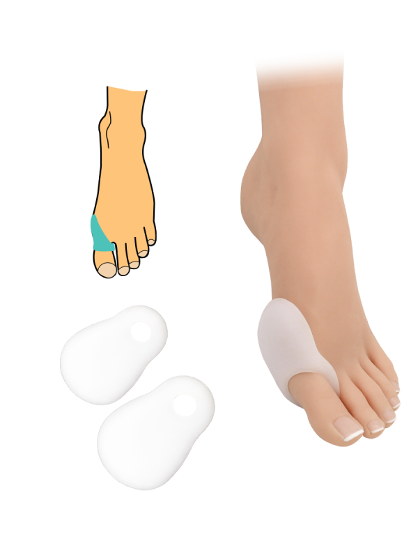 Hallux Valgus Daumengelenkschutz - 2 Stk