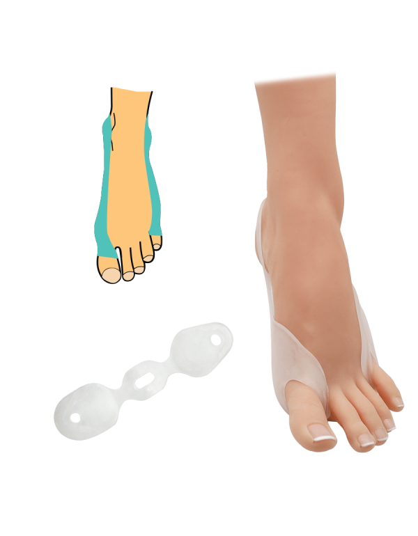 Hallux-Verband