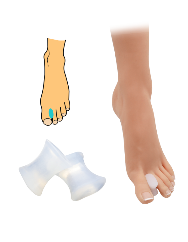 Hallux-valgus-Korrekturorthese – 2 Stück